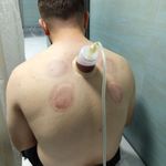 طب سنتی الف