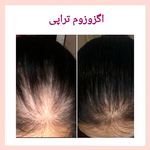 مرکز لیزر و کلینیک زیبایی بهاران