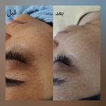خدمات تخصصی پوست  سمیه اکرمی