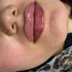 کلینیک زیبایی و جوانسازی پوست و مو الین