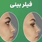 کلینیک پوست،مو،زیبایی،مرکز لیزر ‌پرنسا