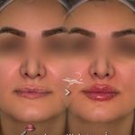 مرکز تخصصی لیزر باران