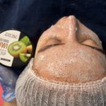 خدمات تخصصی فیشال  پوست رضوان