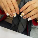 کاشت و ترمیم ناخن آس نیل تهرانسر