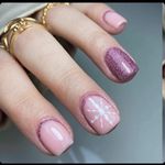 کاشت و ترمیم ناخن آس نیل تهرانسر