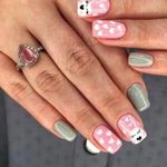 کاشت و ترمیم ناخن آس نیل تهرانسر