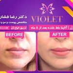 دکتر رضا جعفری فشارکی متخصص پوست، مو، زیبایی و لیزر