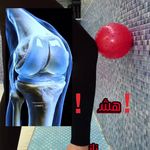 ورزش درآب(اکوافیتنس)آبدرمانی حرکت اصلاحی