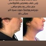 کلینیک زیبایی دکتراحمدقدیانفر