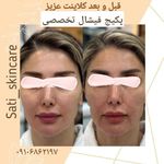 فیشال و پاکسازی تخصصی ساتی