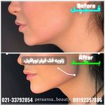 کلینیک پوست،مو،زیبایی،مرکز لیزر ‌پرنسا