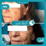 کلینیک تخصصی پوست، مو ،زیبایی ایران