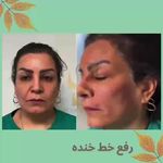 مرکز لیزر مرکز زیبایی دکتر مهسا رحیمی