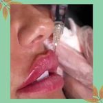 مرکز لیزر مرکز زیبایی دکتر مهسا رحیمی