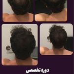 مرکز قطع ریزش و رویش مو و ریش عابدینی