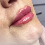 مرکز تخصصی لیزر و زیبایی سعادت آباد