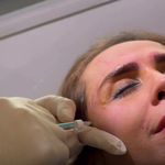 کلینیک زیبایی و مرکز لیزر V