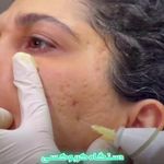 کلینیک زیبایی و مرکز لیزر V