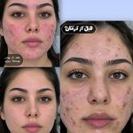 فیشیال / خدمات پوست / سالن زیبایی