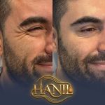 کلینیک زیبایی هانیل