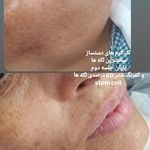 خدمات تخصصی ودرمانی با سلولهای بنیادی