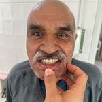 دندانسازی داود یارمحمدی