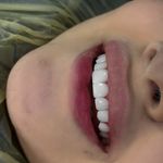 کلینیک پوست،مو و لیزر زینا مختاری