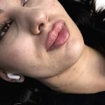مرکز تخصصی لیزر موهای زائد پریناز شرق
