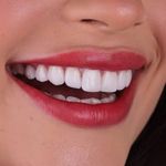 کلینیک دندانپزشکی خاورمیانه نقد و اقساط