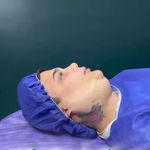 کلینیک جراحی سوپرکانتورینگ غبغب وی لاین