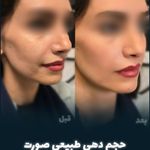 کلینیک زیبایی بنیتا