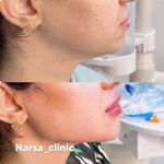 کلینیک پوست مو زیبایی فیلر بوتاکس نارسا