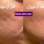 خدمات تخصصی فیشیال لیاناز اسکین هوم