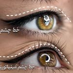 بهترین میکروبلیدینگ و فیبروز خرازی