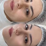 مرکز تخصصی فیبرز ابر‌و حمیده رحیمی