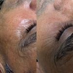 پاکسازی پوست و‌فیشال تخصصی زهراعبدالهیان