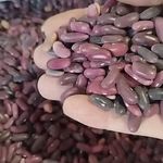 فروش حبوبات اعلا