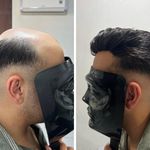 مرکز لیزر پردیس