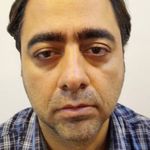 کلینیک کاشت مو مهسا محمدی