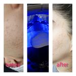 خدمات تخصصی پاکسازی پوست و فیشیال مهشید