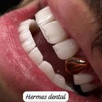 دندانپزشکی هرمس