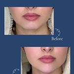 کلینیک زیبایی و مرکز لیزر ماری اسکین