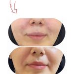 کلینیک زیبایی و مرکز لیزر ماری اسکین