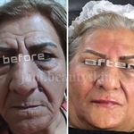 کلینیک زیبایی پوست و مو کارین