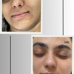 خدمات تخصصی فیشال و پاکسازی پوست صبا