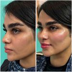 پاکسازی و فیشال تخصصی پوست جنابی،آموزش