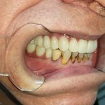 مطب ایمپلنت دکتر نیما شفیعی