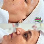 سالن زیبایی مراقبت پوست ،فیشال