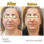 مرکز زیبایی,بوتاکس و لیزر آروشا