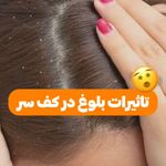 مرکزتخصصی رنگ،درمان،اسکالپ عارفه باقری